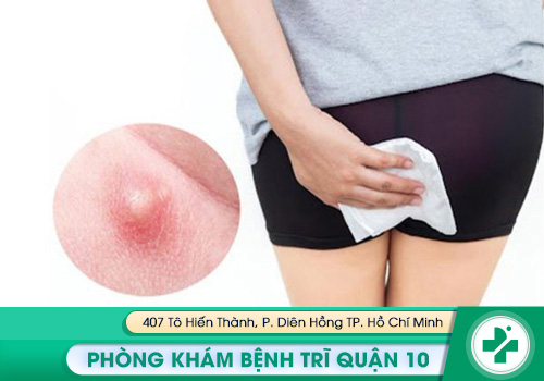 Mụn nhọt xuất hiện ở hậu môn do nhiều nguyên nhân khác nhau.