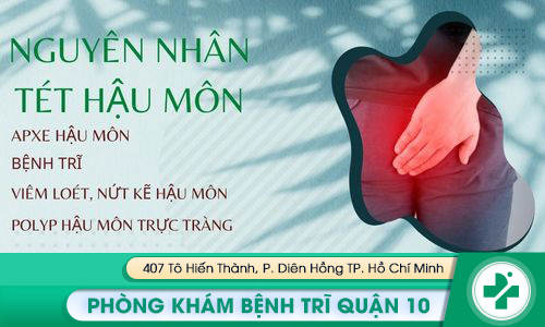 tét hậu môn